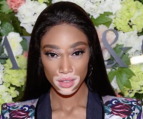 Exploring Winnie Harlow's Personal and Professional Life