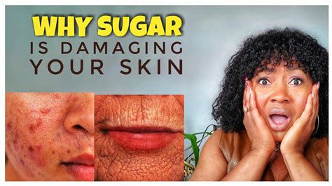 The Phenomenon of Sugar Skin's Ascent